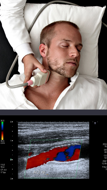 DUPLEX - Sonography - Ultrasound, Neurologist, Dubai, UAE