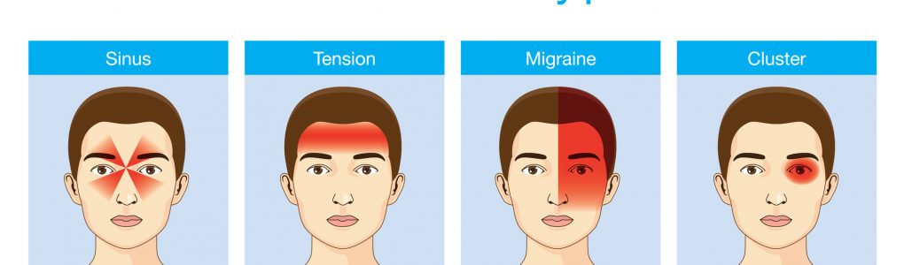 Headaches 4 type on different area of patient head.Illustration about heath care and medical