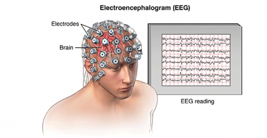 EEG - Electroencephalography