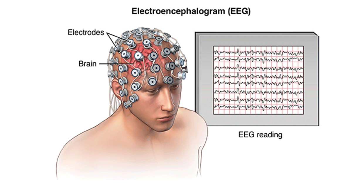 EEG Electroencephalography