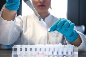 Huntington’s Disease